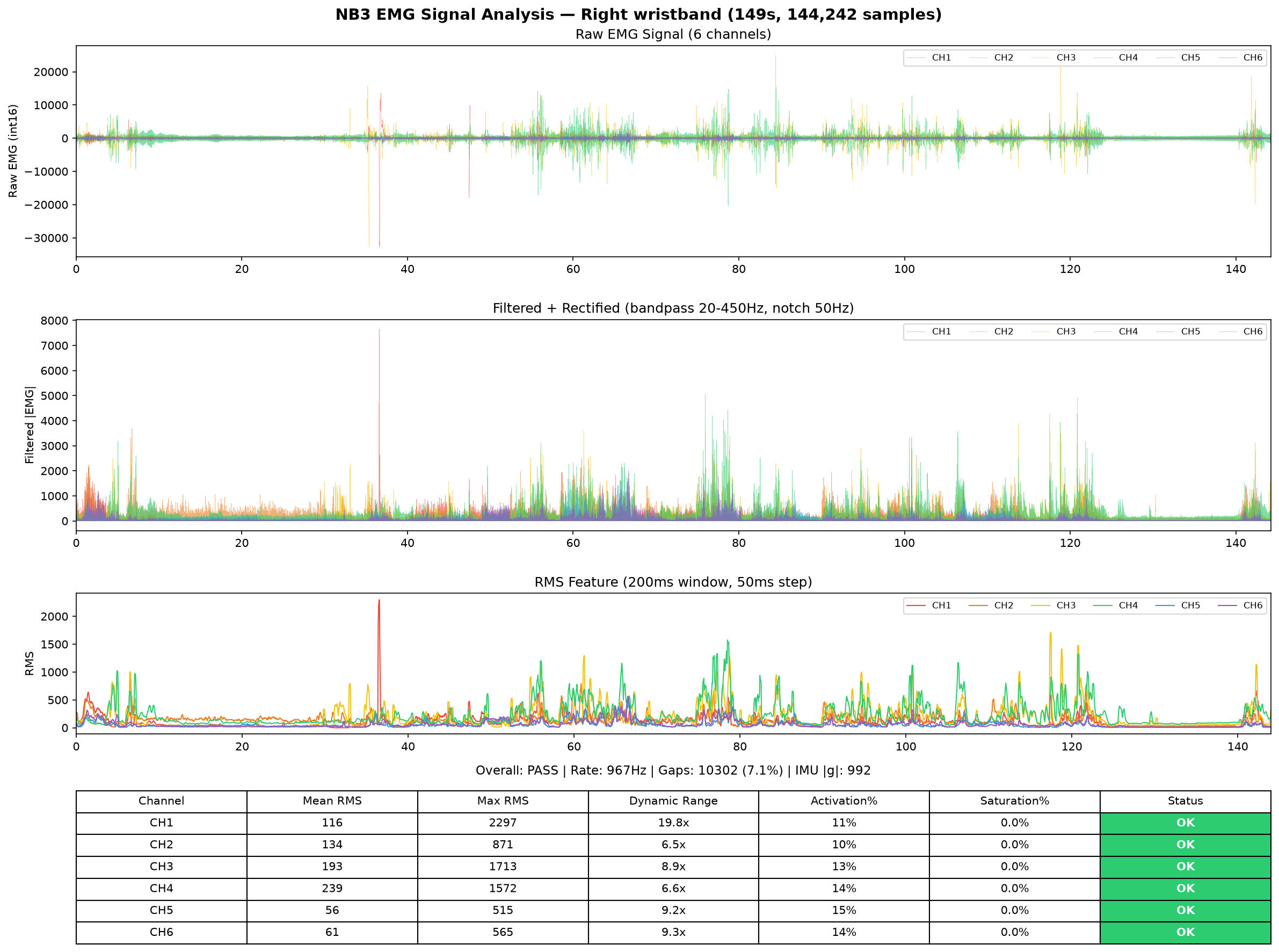Right hand EMG analysis