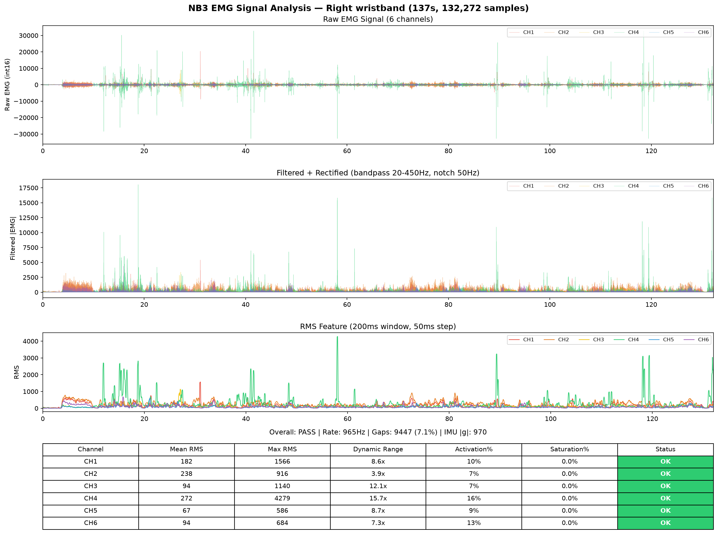 EMG analysis right