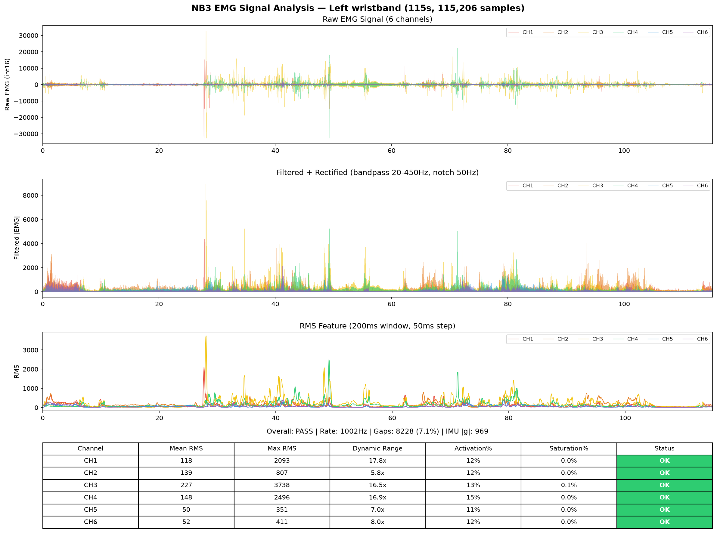 Left hand EMG analysis