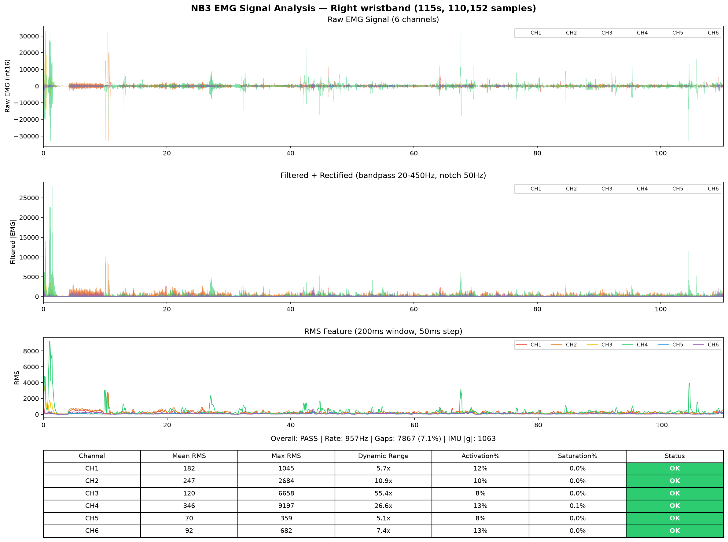 Right hand EMG analysis