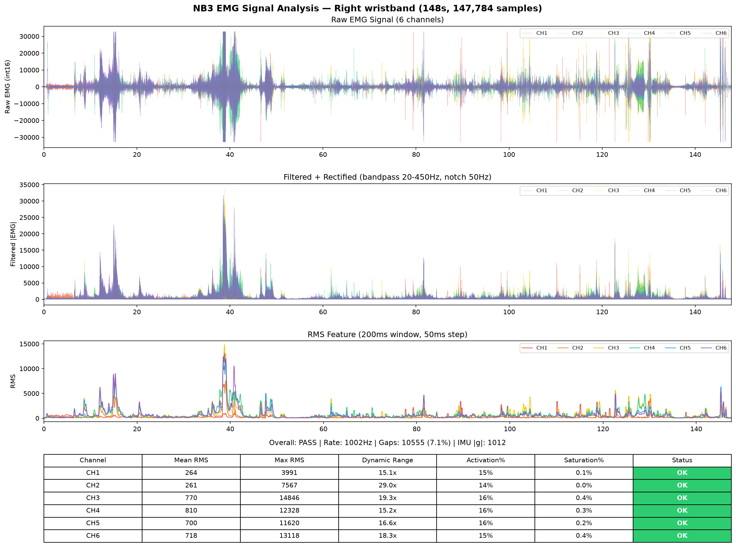 Right hand EMG analysis