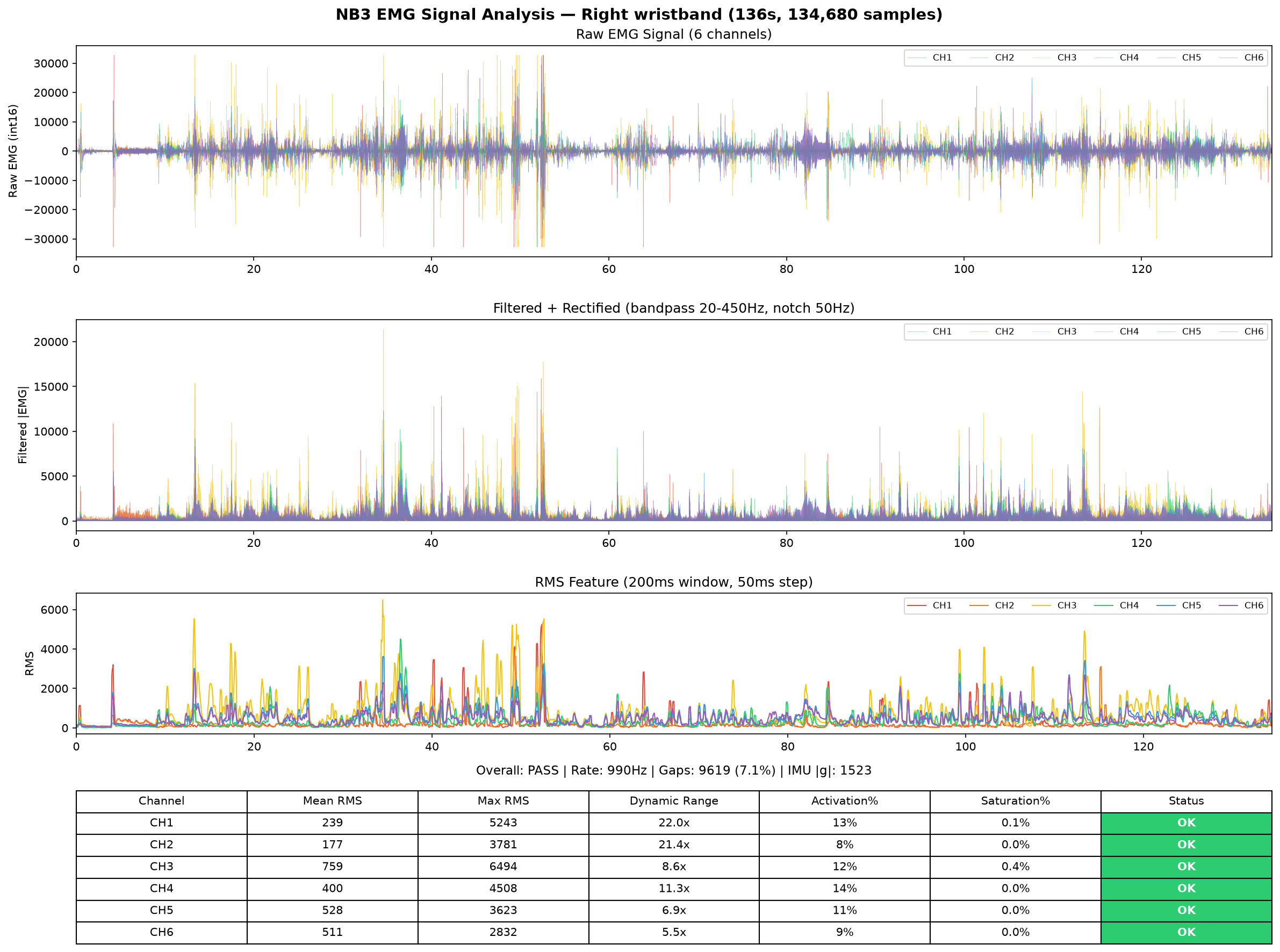 Right hand EMG analysis