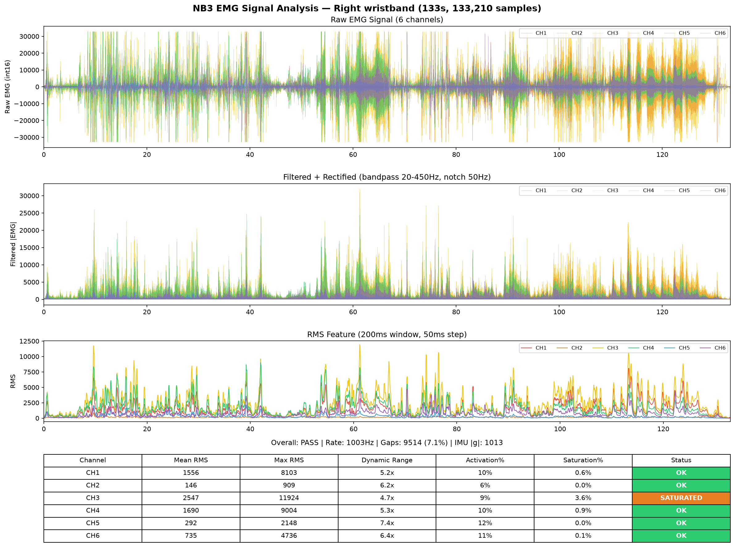 Right hand EMG analysis