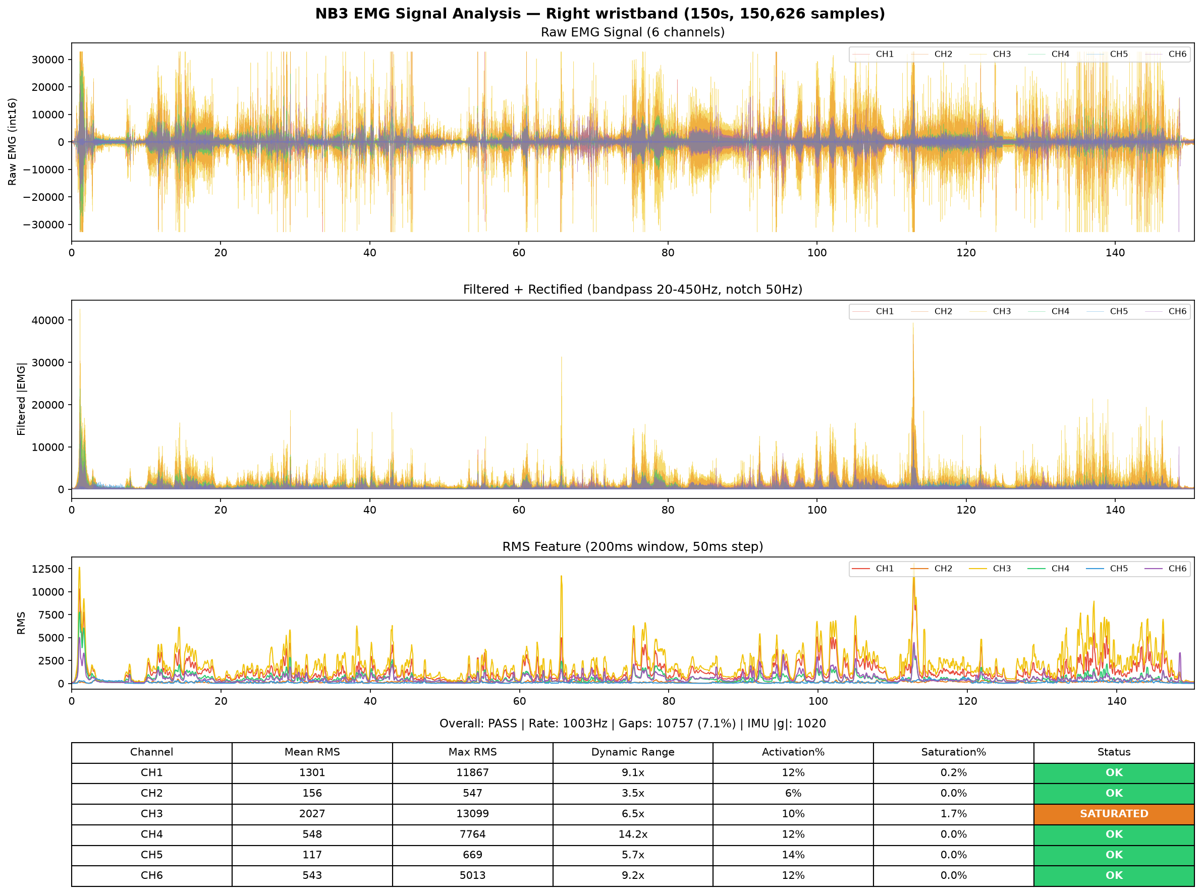 Right hand EMG analysis