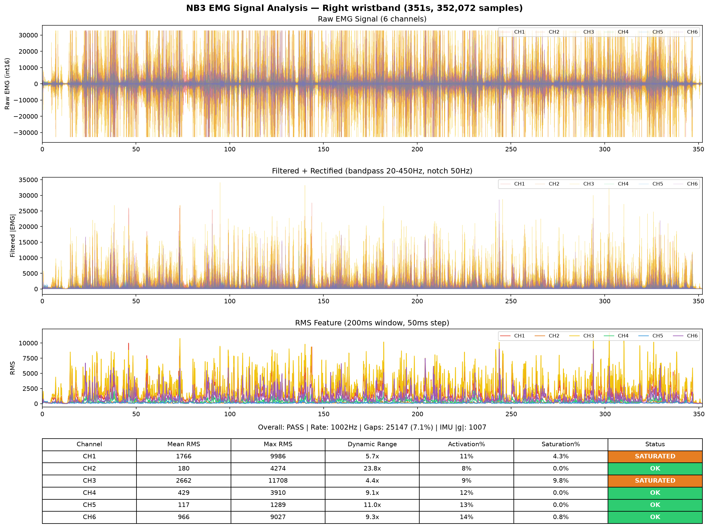 EMG analysis right 175635