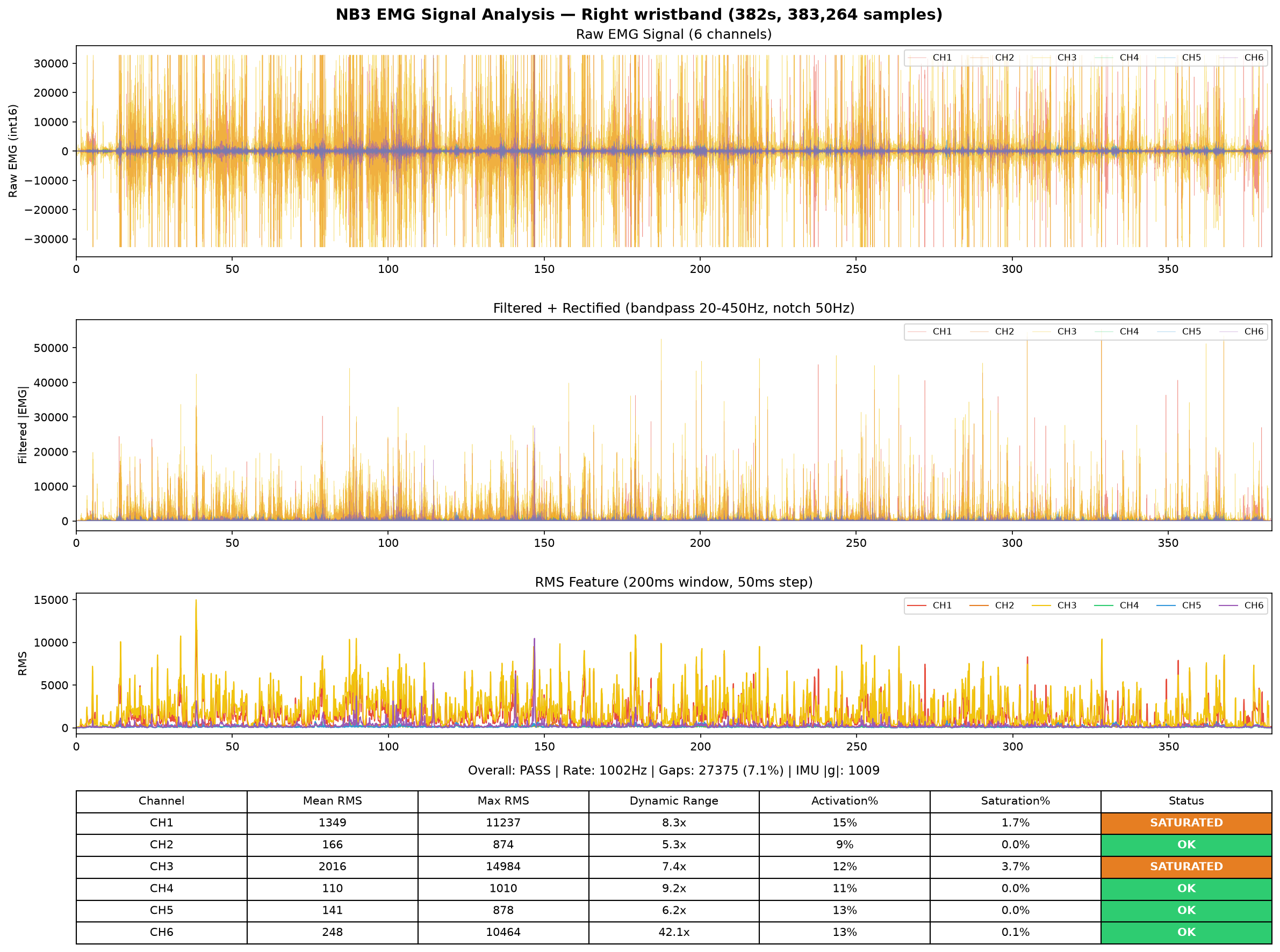 Right hand EMG analysis