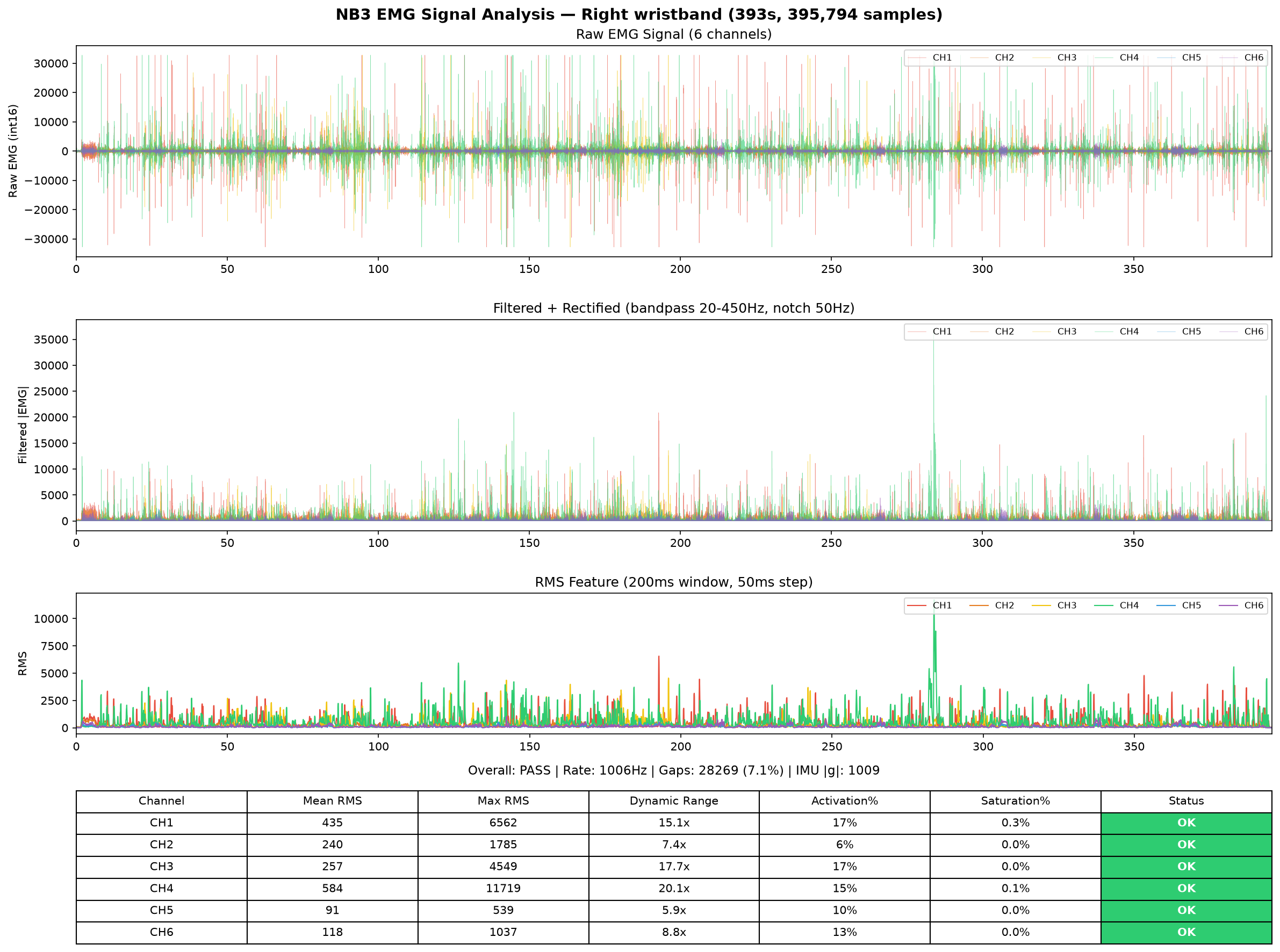 Right hand EMG analysis